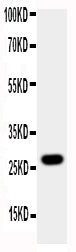 Anti-Aquaporin 8/AQP8 Antibody Picoband®