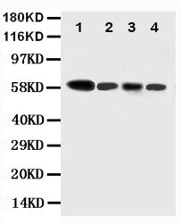 Anti-Caspase-10 antibody, PA1513, Western blotting
Lane 1: COLO320 Cell Lysate
Lane 2: HELA Cell Lysate
Lane 3: SW620 Cell Lysate
Lane 4: RAJI Cell Lysate