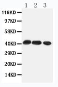 Anti-CCR4 antibody, PA1517, Western blotting
All lanes: Anti CCR4 (PA1517) at 0.5ug/ml
Lane 1: Rat Thymus Tissue Lysate at 50ug
Lane 2: Rat Spleen Tissue Lysate at 50ug
Lane 3: HEPA Whole Cell Lysate at 40ug
Predicted bind size: 41KD
Observed bind size: 41KD