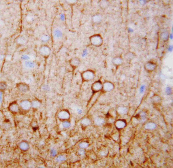 Anti-CaMKK/CAMKK1 Antibody Picoband®