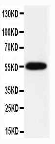 Anti-Caspase-8(P10) antibody, PA1524, Western blotting
WB: HELA Cell Lysate