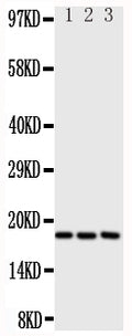 Anti-I-309 antibody, PA1525, Western blotting
All lanes: Anti I-309 (PA1525) at 0.5ug/ml

Lane 1: SCG Whole Cell Lysate at 40ug

Lane 2: COLO320 Whole Cell Lysate at 40ug

Lane 3: JURKAT Whole Cell Lysate at 40ug

Predicted bind size: 11KD

Observed bind size: 18KD