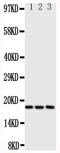 Anti-I-309 antibody, PA1525, Western blotting
All lanes: Anti I-309 (PA1525) at 0.5ug/ml

Lane 1: SCG Whole Cell Lysate at 40ug

Lane 2: COLO320 Whole Cell Lysate at 40ug

Lane 3: JURKAT Whole Cell Lysate at 40ug

Predicted bind size: 11KD

Observed bind size: 18KD