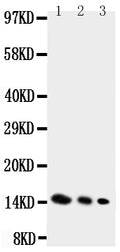Anti-IL-4 antibody, PA1529, Western blotting
Lane 1: Recombinant Mouse IL-4 Protein 10ng
Lane 2: Recombinant Mouse IL-4 Protein 5ng
Lane 3: Recombinant Mouse IL-4 Protein 2.5ng