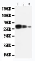 Anti-ADAM10 antibody, PA1535, Western blotting
Lane 1: Recombinant Human ADAM10 Protein 10ng
Lane 2: Recombinant Human ADAM10 Protein 5ng
Lane 3: Recombinant Human ADAM10 Protein 2.5ng