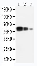 Anti-ADAM10 antibody, PA1535, Western blotting
Lane 1: Recombinant Human ADAM10 Protein 10ng
Lane 2: Recombinant Human ADAM10 Protein 5ng
Lane 3: Recombinant Human ADAM10 Protein 2.5ng