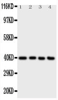 Anti-ATF4 antibody, PA1537, Western blotting
All lanes: Anti ATF4 (PA1537) at 0.5ug/ml

Lane 1: A431 Whole Cell Lysate at 40ug

Lane 2: RAJI Whole Cell Lysate at 40ug

Lane 3: CEM Whole Cell Lysate at 40ug

Lane 4: HUT Whole Cell Lysate at 40ug

Predicted bind size: 39KD

Observed bind size: 39KD