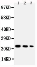 Anti-BAFF antibody, PA1541, Western blotting
Lane 1: Recombinant Human BAFF Protein 10ng
Lane 2: Recombinant Human BAFF Protein 5ng
Lane 3: Recombinant Human BAFF Protein 2.5ng