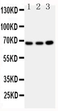 Anti-GBP1 antibody, PA1550, Western blotting
All lanes: Anti GBP1 (PA1550) at 0.5ug/ml

Lane 1: U87 Whole Cell Lysate at 40ug

Lane 2: HELA Whole Cell Lysate at 40ug

Lane 3: MCF-7 Whole Cell Lysate at 40ug

Predicted bind size: 68KD

Observed bind size: 68KD