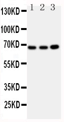 Anti-GBP1 antibody, PA1550, Western blotting
All lanes: Anti GBP1 (PA1550) at 0.5ug/ml

Lane 1: U87 Whole Cell Lysate at 40ug

Lane 2: HELA Whole Cell Lysate at 40ug

Lane 3: MCF-7 Whole Cell Lysate at 40ug

Predicted bind size: 68KD

Observed bind size: 68KD