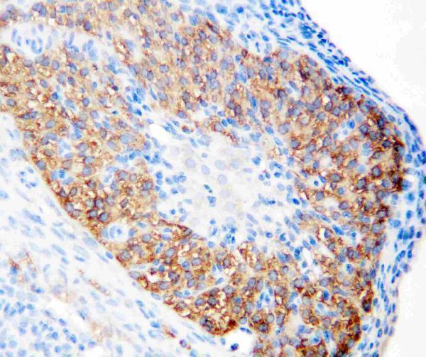 Anti-hCG receptor/LHCGR Antibody Picoband®