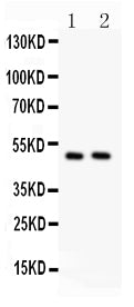 Anti-c-Myc antibody, PA1555, Western blotting
All lanes: Anti c-Myc(PA1555) at 0.5ug/ml
Lane 1: HELA Whole Cell Lysate at 40ug
Lane 2: HEPG2 Whole Cell Lysate at 40ug
Predicted bind size: 49KD
Observed bind size: 49KD