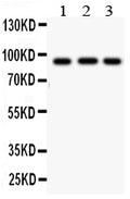 Anti-Cullin 1 antibody, PA1557, Western blotting
All lanes: Anti Cullin 1 (PA1557) at 0.5ug/ml
Lane 1: MM453 Whole Cell Lysate at 40ug
Lane 2: HT1080 Whole Cell Lysate at 40ug
Lane 3: SMMC Whole Cell Lysate at 40ug
Predicted bind size: 90 KD
Observed bind size: 90 KD