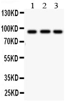 Anti-Cullin 1 antibody, PA1557, Western blotting
All lanes: Anti Cullin 1 (PA1557) at 0.5ug/ml
Lane 1: MM453 Whole Cell Lysate at 40ug
Lane 2: HT1080 Whole Cell Lysate at 40ug
Lane 3: SMMC Whole Cell Lysate at 40ug
Predicted bind size: 90 KD
Observed bind size: 90 KD