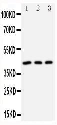 Anti-DAP Kinase 2 antibody, PA1558, Western blotting
All lanes: Anti DAP Kinase 2 (PA1558) at 0.5ug/ml

Lane 1: U87 Whole Cell Lysate at 40ug

Lane 2: MCF-7 Whole Cell Lysate at 40ug

Lane 3: SMMC Whole Cell Lysate at 40ug

Predicted bind size: 43KD

Observed bind size: 43KD