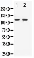 Anti-Eph receptor B3 antibody, PA1569, Western blotting
Lane 1: HELA Cell Lysate
Lane 2: A549 Cell Lysate