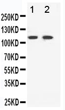 Anti-Eph receptor B3 antibody, PA1569, Western blotting
Lane 1: HELA Cell Lysate
Lane 2: A549 Cell Lysate