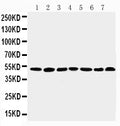 Anti-C-terminal-binding protein 1 CtBP1 Antibody Picoband®