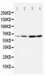 Anti-DRD1 antibody, PA1571, Western blotting
Lane 1: Rat Testis Tissue Lysate
Lane 2: Rat Brain Tissue Lysate
Lane 3: U87 Cell Lysate
Lane 4: HELA Cell Lysate