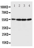 Anti-Fascin antibody, PA1575, Western blotting
All lanes: Anti Fascin (PA1575) at 0.5ug/ml

Lane 1: U87 Whole Cell Lysate at 40ug

Lane 2: A549 Whole Cell Lysate at 40ug

Lane 3: MCF-7 Whole Cell Lysate at 40ug

Lane 4: HT1080 Whole Cell Lysate at 40ug

Predicted bind size: 55KD

Observed bind size: 55KD