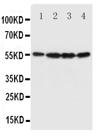 Anti-Fascin antibody, PA1575, Western blotting
All lanes: Anti Fascin (PA1575) at 0.5ug/ml

Lane 1: U87 Whole Cell Lysate at 40ug

Lane 2: A549 Whole Cell Lysate at 40ug

Lane 3: MCF-7 Whole Cell Lysate at 40ug

Lane 4: HT1080 Whole Cell Lysate at 40ug

Predicted bind size: 55KD

Observed bind size: 55KD