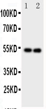 Anti-GABA A Receptor alpha 1/GABRA1 Antibody Picoband®