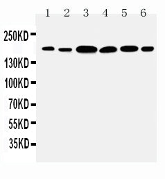 Anti-Laminin gamma 1 antibody, PA1581, Western blotting
Lane 1: Rat Kidney Tissue Lysate
Lane 2: Rat Lung Tissue Lysate
Lane 3: U87 Cell Lysate
Lane 4: SMMC Cell Lysate
Lane 5: HELA Cell Lysate
Lane 6: SKOV1 Cell Lysate