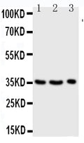 Anti-Granzyme A antibody, PA1588, Western blotting
Lane 1: JURKAT Cell Lysate
Lane 2: CEM Cell Lysate
Lane 3: RAJI Cell Lysate