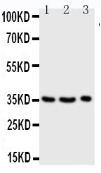 Anti-Granzyme A antibody, PA1588, Western blotting
Lane 1: JURKAT Cell Lysate
Lane 2: CEM Cell Lysate
Lane 3: RAJI Cell Lysate