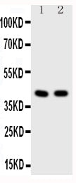 Anti-HDAC8 antibody, PA1591, Western blotting
All lanes: Anti HDAC8 (PA1591) at 0.5ug/ml

Lane 1: Rat Cardiac Muscle: Tissue Lysate at 50ug

Lane 2: A549 Whole Cell Lysate at 40ug

Predicted bind size: 42KD

Observed bind size: 42KD