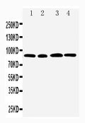Anti-CD168 antibody, PA1592, Western blotting
Lane 1: MM231 Cell Lysate
Lane 2: MM453 Cell Lysate
Lane 3: HELA Cell Lysate
Lane 4: A549 Cell Lysate