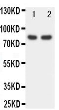 Anti-FOXP1 antibody, PA1593, Western blotting
Lane 1: Rat Spleen Tissue Lysate
Lane 2: COLO320 Cell Lysate