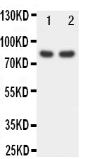 Anti-FOXP1 antibody, PA1593, Western blotting
Lane 1: Rat Spleen Tissue Lysate
Lane 2: COLO320 Cell Lysate