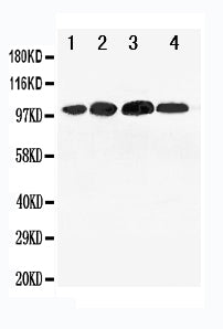 Lane 1: 293T Cell Lysate
Lane 2: SMMC Cell Lysate
Lane 3: SW620 Cell Lysate
Lane 4: HELA Cell Lysate