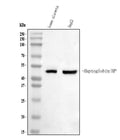 Anti-Haptoglobin/HP Antibody Picoband®