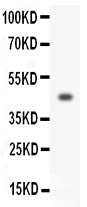 Anti-HOXA3 antibody, PA1602, Western blotting
All lanes: Anti HOXA3 (PA1602) at 0.5ug/ml
WB: SW620 Whole Cell Lysate at 40ug
Predicted bind size: 46KD
Observed bind size: 46KD