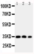 Anti-HOXA4 antibody, PA1603, Western blotting
Lane 1: SW620 Cell Lysate 
Lane 2: SW620 Cell Lysate
Lane 3: PC-12 Cell Nuclear Lysate