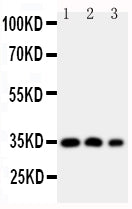 Anti-HOXA4 antibody, PA1603, Western blotting
Lane 1: SW620 Cell Lysate 
Lane 2: SW620 Cell Lysate
Lane 3: PC-12 Cell Nuclear Lysate