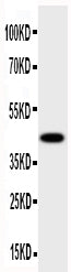 Anti-HSD17B2 antibody, PA1604, Western blotting
All lanes: Anti HSD17B2 (PA1604) at 0.5ug/ml
WB: Human Placenta Tissue Lysate at 50ug
Predicted bind size: 43KD
Observed bind size: 43KD