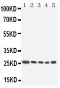 Anti-HOXA6 antibody, PA1605, Western blotting
Lane 1: SW620 cell Lysate
Lane 2: SW620 cell Lysate
Lane 3: HELA cell Lysate
Lane 4: HT1080 cell Lysate
Lane 5: HT1080 cell Lysate