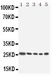Anti-HOXA6 antibody, PA1605, Western blotting
Lane 1: SW620 cell Lysate
Lane 2: SW620 cell Lysate
Lane 3: HELA cell Lysate
Lane 4: HT1080 cell Lysate
Lane 5: HT1080 cell Lysate