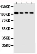 Anti-Hsp105 antibody, PA1608, Western blotting
Lane 1: Rat Ovary Tissue Lysate 
Lane 2: A549 Cell Lysate 
Lane 3: U87 Cell Lysate 
Lane 4: HELA Cell Lysate