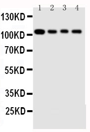 Anti-Hsp105 antibody, PA1608, Western blotting
Lane 1: Rat Ovary Tissue Lysate 
Lane 2: A549 Cell Lysate 
Lane 3: U87 Cell Lysate 
Lane 4: HELA Cell Lysate
