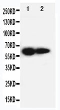 Anti-IL2RB antibody, PA1615, Western blotting
Lane 1: PANC Cell Lysate 
Lane 2: HELA Cell Lysate