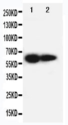 Anti-IL2RB antibody, PA1615, Western blotting
Lane 1: PANC Cell Lysate 
Lane 2: HELA Cell Lysate
