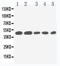Anti-IL2 Receptor gamma antibody, PA1616, Western blotting
Lane 1: PANC Cell Lysate 
Lane 2: HELA Cell Lysate 
Lane 3: JURKAT Cell Lysate 
Lane 4: RAJI Cell Lysate 
Lane 5: CEM Cell Lysate
