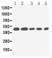Anti-IL2 Receptor gamma antibody, PA1616, Western blotting
Lane 1: PANC Cell Lysate 
Lane 2: HELA Cell Lysate 
Lane 3: JURKAT Cell Lysate 
Lane 4: RAJI Cell Lysate 
Lane 5: CEM Cell Lysate
