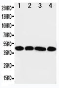 Anti-IL3RA antibody, PA1617, Western blotting
Lane 1: A431 Cell Lysate 
Lane 2: SMMC Cell Lysate
Lane 3: U87 Cell Lysate
Lane 4: 293T Cell Lysate