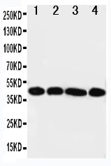 Anti-IL3RA antibody, PA1617, Western blotting
Lane 1: A431 Cell Lysate 
Lane 2: SMMC Cell Lysate
Lane 3: U87 Cell Lysate
Lane 4: 293T Cell Lysate