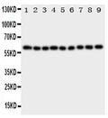 Anti-IL5RA antibody, PA1619, Western blotting
All lanes: Anti IL5RA (PA1619) at 0.5ug/ml

Lane 1: A549 Whole Cell Lysate at 40ug

Lane 2: SMMC Whole Cell Lysate at 40ug

Lane 3: U87 Whole Cell Lysate at 40ug

Lane 4: 293T Whole Cell Lysate at 40ug

Lane 5: PANC Whole Cell Lysate at 40ug

Lane 6: HELA Whole Cell Lysate at 40ug

Lane 7: JURKAT Whole Cell Lysate at 40ug

Lane 8: RAJI Whole Cell Lysate at 40ug

Lane 9: CEM Whole Cell Lysate at 40ug

Predicted bind size: 48KD

Observed bind size: 60KD